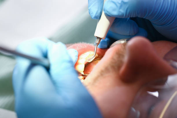 Best Emergency Denture Repair in Taylor, MI
